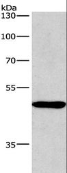 BMP15 Antibody - Western blot analysis of A549 cell, using BMP15 Polyclonal Antibody at dilution of 1:266.7.