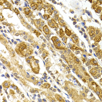 BMP15 Antibody - Immunohistochemistry of paraffin-embedded human stomach using BMP15 antibody at dilution of 1:100 (x40 lens).