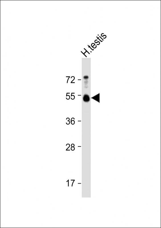 BMP15 Antibody - Anti-BMP15 Antibody at 1:4000 dilution + Human testis lysate Lysates/proteins at 20 µg per lane. Secondary Goat Anti-Rabbit IgG, (H+L), Peroxidase conjugated at 1/10000 dilution. Predicted band size: 45 kDa Blocking/Dilution buffer: 5% NFDM/TBST.