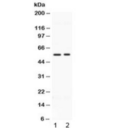BMP15 Antibody - Western blot testing of human 1) HeLa and 2) MCF7 cell lysate with BMP15 antibody at 0.5ug/ml. Routinly observed molecular weight: ~50 kDa pro form and 16-17 kDa mature form.