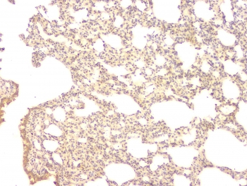 BMP15 Antibody - IHC staining of FFPE rat lung with BMP15 antibody at 1ug/ml. HIER: boil tissue sections in pH6, 10mM citrate buffer, for 10-20 min and allow to cool before testing.