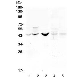 BMP15 Antibody - Western blot testing of 1) human HeLa, 2) human placenta, 3) human Caco-2, 4) rat lung and 5 mouse lung lysate with BPM15 antibody at 0.5ug/ml.Routinely observed molecular weight: ~50 kDa pro form and 16-17 kDa mature form.