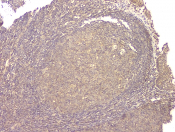 BMP15 Antibody - IHC staining of FFPE human tonil with BMP15 antibody at 1ug/ml. HIER: boil tissue sections in pH6, 10mM citrate buffer, for 10-20 min and allow to cool before testing.