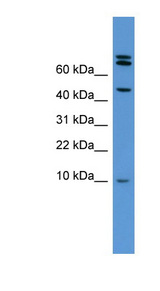 BMP2 Antibody - BMP2 antibody Western blot of Rat Heart lysate. This image was taken for the unconjugated form of this product. Other forms have not been tested.