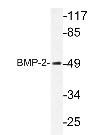 BMP2 Antibody - Western Blot: BMP2 Antibody - Extracts from HUVEC cells.  This image was taken for the unconjugated form of this product. Other forms have not been tested.