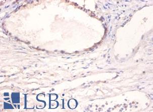 BMP2 Antibody - Immunohistochemistry of paraffin-embedded human prostate using BMP2 antibody at dilution of 1:100.  This image was taken for the unconjugated form of this product. Other forms have not been tested.