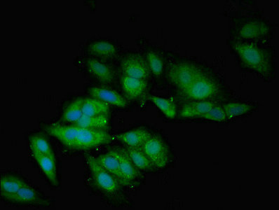 BMP2 Antibody - Immunofluorescent analysis of Hela cells using BMP2 Antibody at dilution of 1:100 and Alexa Fluor 488-congugated AffiniPure Goat Anti-Rabbit IgG(H+L)