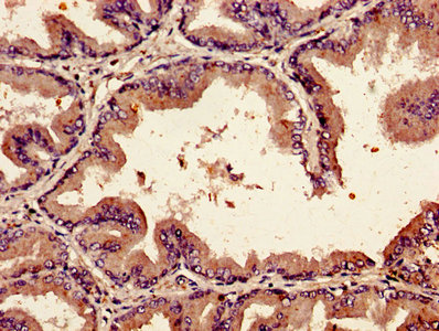 BMP2 Antibody - Immunohistochemistry of paraffin-embedded human prostate tissue using BMP2 Antibody at dilution of 1:100