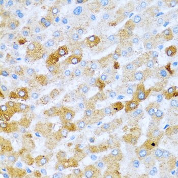 BMP2 Antibody - Immunohistochemistry of paraffin-embedded human liver tissue.