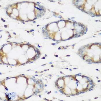 BMP2 Antibody - Immunohistochemistry of paraffin-embedded human colon using BMP2 antibodyat dilution of 1:200 (40x lens).