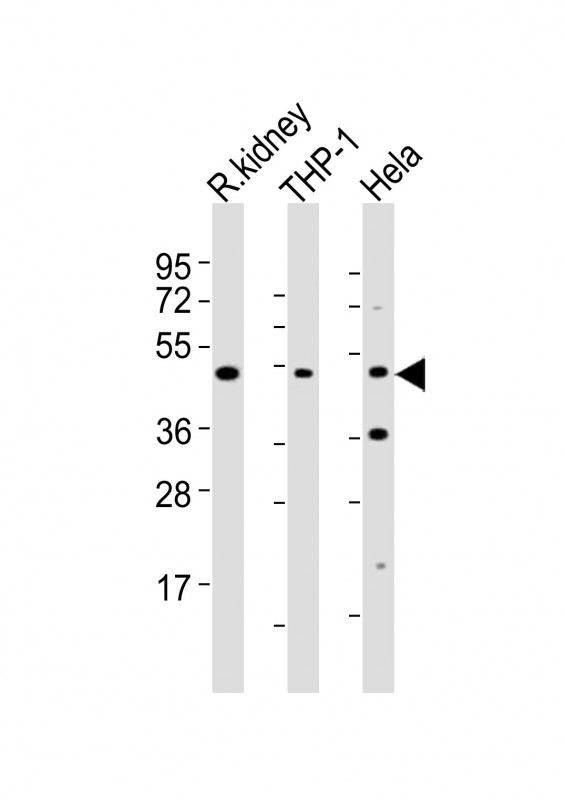 BMP2 Antibody - All lanes : Anti-BMP2 Antibody at 1:2000 dilution Lane 1: rat kidney lysates Lane 2: THP-1 whole cell lysates Lane 3: HeLa whole cell lysates Lysates/proteins at 20 ug per lane. Secondary Goat Anti-Rabbit IgG, (H+L), Peroxidase conjugated at 1/10000 dilution Predicted band size : 45 kDa Blocking/Dilution buffer: 5% NFDM/TBST.