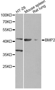 BMP2 Antibody - Western blot analysis of extracts of various cell lines, using BMP2 Antibody at 1:1000 dilution. The secondary antibody used was an HRP Goat Anti-Rabbit IgG (H+L) at 1:10000 dilution. Lysates were loaded 25ug per lane and 3% nonfat dry milk in TBST was used for blocking. An ECL Kit was used for detection and the exposure time was 30s.