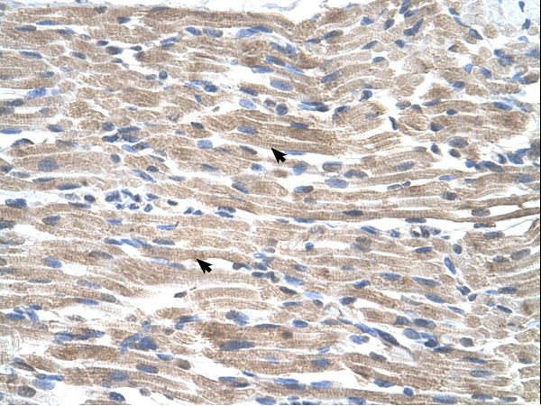 BMP2K / BIKE Antibody - BMP2K antibody BMP2K(BMP2 inducible kinase) Antibody was used in IHC to stain formalin-fixed, paraffin-embedded human muscle.  This image was taken for the unconjugated form of this product. Other forms have not been tested.