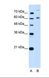 BMP2K / BIKE Antibody - Lane A: Marker. Lane B: HepG2 cell lysate. Antibody concentration: 5.0 ug/ml. Gel concentration: 12%.  This image was taken for the unconjugated form of this product. Other forms have not been tested.
