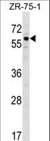 BMP3 Antibody - BMP3 Antibody western blot of ZR-75-1 cell line lysates (35 ug/lane). The BMP3 antibody detected the BMP3 protein (arrow).