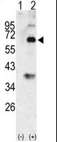 BMP3 Antibody - Western blot of Bmp3 (arrow) using rabbit polyclonal Bmp3 Antibody. 293 cell lysates (2 ug/lane) either nontransfected (Lane 1) or transiently transfected with the Bmp3 gene (Lane 2) (Origene Technologies).