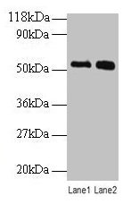 BMP3 Antibody - Western blot All lanes: Bone morphogenetic protein 3 antibody at 2µg/ml Lane 1: SW1990 whole cell lysate Lane 2: 293T whole cell lysate Secondary Goat polyclonal to rabbit IgG at 1/10000 dilution Predicted band size: 53 kDa Observed band size: 53 kDa