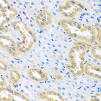 BMP3 Antibody - Immunohistochemistry of paraffin-embedded rat kidney using BMP3 antibody at dilution of 1:100 (40x lens).