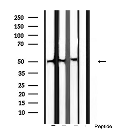 BMP3 Antibody - Western blot analysis of extracts of various sample using BMP3 antibody.