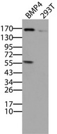 BMP4 Antibody - HEK293T cells transfected pCMV6-ENTRY BTRC  Left lane) cDNA for 48 hrs or HEK293T cells untransfected. (Right lane) were lysed. Equivalent amounts of cell lysates. (5 ug per lane) were separated by SDS-PAGE and immunoblotted with anti-BTRC.