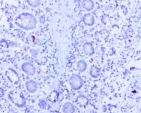 BMP4 Antibody - Immunohistochemical staining of paraffin-embedded human small intestine using BMP4 clone UMAB42, mouse monoclonal antibody at 1:100 dilution of 1mg/mL using Polink2 Broad HRP DAB for detection.requires heat-induced epitope retrieval with Accel pH8.7 at 110C for 3 min using pressure chamber/cooker. The image shows strong membranous and cytoplasmic staining.