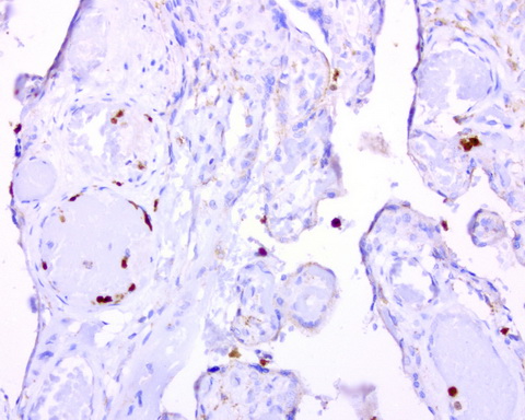 BMP4 Antibody - Immunohistochemical staining of paraffin-embedded human placenta using BMP4 clone UMAB42, mouse monoclonal antibody at 1:100 dilution of1mg/mL using Polink2 Broad HRP DAB for detection.requires heat-induced epitope retrieval with Accel pH8.7 at 110C for 3 min using pressure chamber/cooker. The image shows strong membranous and cytoplasmic staining.