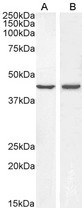 BMP4 Antibody - Goat anti-BMP4 Antibody (0.3µg/ml) staining of A431 (A) and HeLa (B) lysate (35µg protein in RIPA buffer). Primary incubation was 1 hour. Detected by chemiluminescencence.
