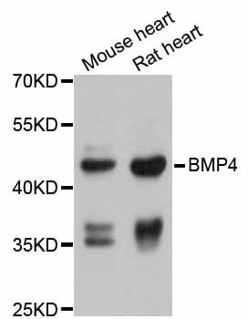 BMP4 Antibody - Western blot analysis of extracts of various cell lines, using BMP4 antibody at 1:1000 dilution. The secondary antibody used was an HRP Goat Anti-Rabbit IgG (H+L) at 1:10000 dilution. Lysates were loaded 25ug per lane and 3% nonfat dry milk in TBST was used for blocking. An ECL Kit was used for detection and the exposure time was 5s.