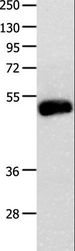 BMP4 Antibody - Western blot analysis of Mouse intestinumm tenue tissue, using BMP4 Polyclonal Antibody at dilution of 1:450.