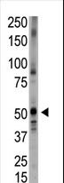BMP5 Antibody - The anti-Bmp5 N-term antibody is used in Western blot to detect Bmp5 in placenta tissue lysate.