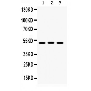BMP5 Antibody - BMP5 antibody Western blot. All lanes: Anti BMP5 at 0.5 ug/ml. Lane 1: Rat Liver Tissue Lysate at 50 ug. Lane 2: Mouse Liver Tissue Lysate at 50 ug. Lane 3: A549 Whole Cell Lysate at 40 ug. Predicted band size: 51 kD. Observed band size: 51 kD.