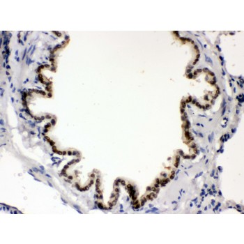 BMP5 Antibody - BMP5 antibody IHC-paraffin. IHC(P): Rat Lung Tissue.