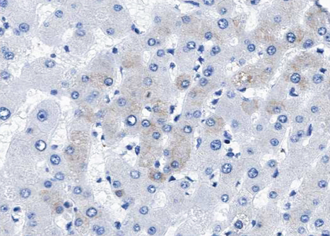 BMP5 Antibody - 1:100 staining human liver tissue by IHC-P. The tissue was formaldehyde fixed and a heat mediated antigen retrieval step in citrate buffer was performed. The tissue was then blocked and incubated with the antibody for 1.5 hours at 22°C. An HRP conjugated goat anti-rabbit antibody was used as the secondary.