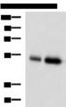 BMP5 Antibody - Western blot analysis of Human placenta tissue and Human right lower lung tissue lysates  using BMP5 Polyclonal Antibody at dilution of 1:450