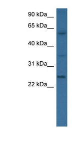 BMP6 Antibody - BMP6 antibody Western blot of 721_B cell lysate. This image was taken for the unconjugated form of this product. Other forms have not been tested.