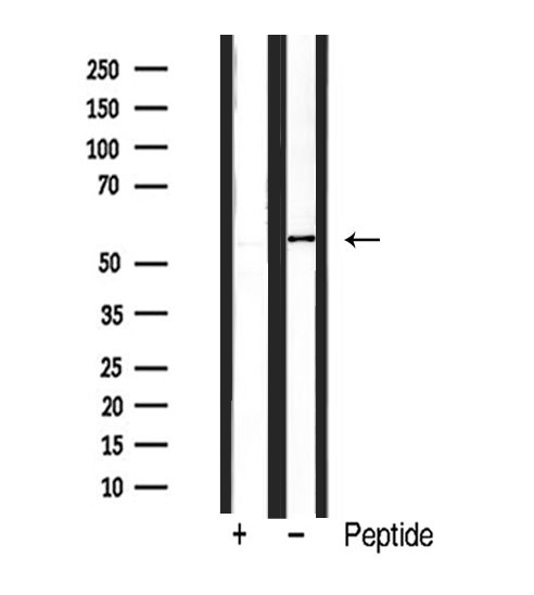 BMP6 Antibody - Western blot analysis of BMP6 expression in 293 cells