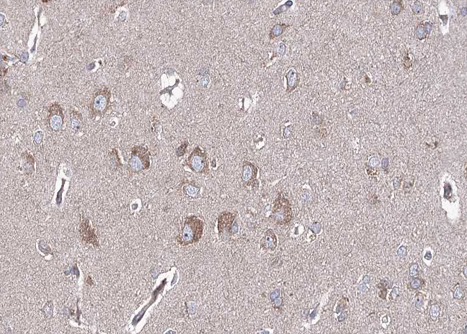 BMP6 Antibody - 1:100 staining human brain tissue by IHC-P. The tissue was formaldehyde fixed and a heat mediated antigen retrieval step in citrate buffer was performed. The tissue was then blocked and incubated with the antibody for 1.5 hours at 22°C. An HRP conjugated goat anti-rabbit antibody was used as the secondary.