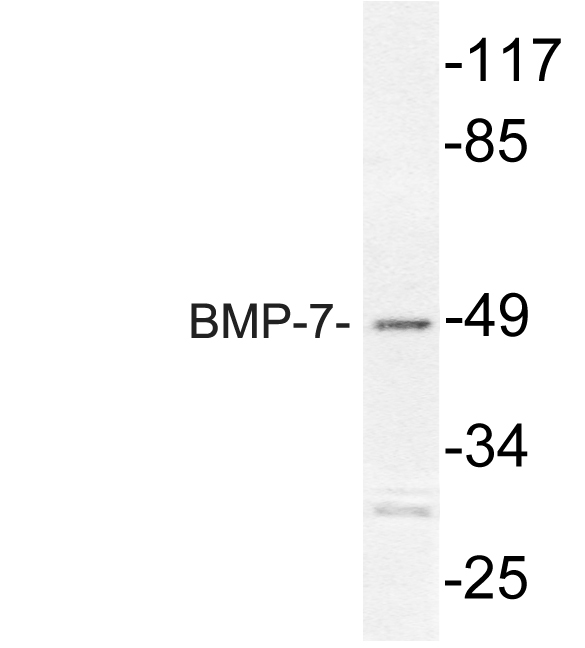 BMP7 Antibody - Western blot analysis of lysate from Jurkat cells, using BMP-7 antibody.