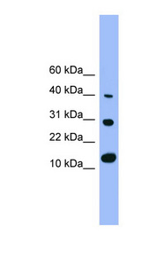 BMP7 Antibody - BMP7 antibody Western blot of Rat Lung lysate. This image was taken for the unconjugated form of this product. Other forms have not been tested.