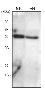 BMP7 Antibody - The extracts of mouse kidney (MK) and rat heart (RH) were resolved by SDS-PAGE, transferred to PVDF membrane and probed with anti-human BMP7 antibody (1:1000). Protein was visualized using a goat anti-mouse secondary antibody conjugated to HRP and an ECL detection system.