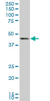 BMP7 Antibody - BMP7 monoclonal antibody (M01), clone M1-F8. Western Blot analysis of BMP7 expression in human uterus myoma.