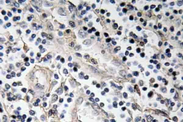 BMP7 Antibody - IHC of BMP-7 (E173) pAb in paraffin-embedded human tonsil tissue.