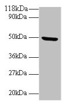 BMP7 Antibody - Western blot All lanes: Bone morphogenetic protein 7 antibody at 2µg/ml + Mouse kidney tissue Secondary Goat polyclonal to rabbit IgG at 1/10000 dilution Predicted band size: 49 kDa Observed band size: 49 kDa