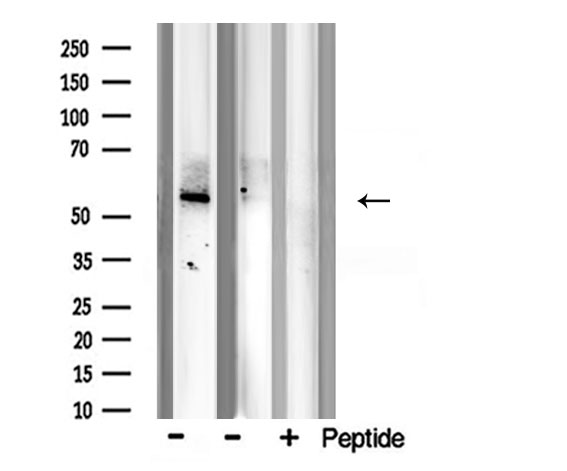 BMP7 Antibody - Western blot analysis of BMP7 expression in Jurkat cells