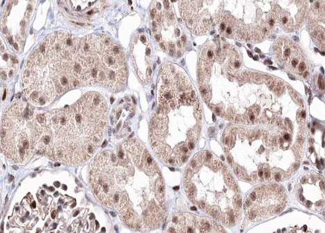 BMP7 Antibody - 1:100 staining human kidney tissue by IHC-P. The tissue was formaldehyde fixed and a heat mediated antigen retrieval step in citrate buffer was performed. The tissue was then blocked and incubated with the antibody for 1.5 hours at 22°C. An HRP conjugated goat anti-rabbit antibody was used as the secondary.