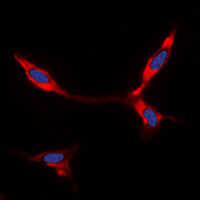 BMP8A Antibody - Immunofluorescent analysis of BMP8A staining in A549 cells. Formalin-fixed cells were permeabilized with 0.1% Triton X-100 in TBS for 5-10 minutes and blocked with 3% BSA-PBS for 30 minutes at room temperature. Cells were probed with the primary antibody in 3% BSA-PBS and incubated overnight at 4 C in a humidified chamber. Cells were washed with PBST and incubated with a DyLight 594-conjugated secondary antibody (red) in PBS at room temperature in the dark. DAPI was used to stain the cell nuclei (blue).