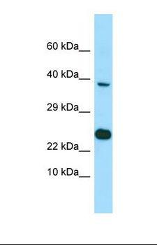 BMP8B Antibody - Western blot of NCI-H226. EBNA1BP2 antibody dilution 1.0 ug/ml.  This image was taken for the unconjugated form of this product. Other forms have not been tested.
