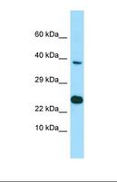 BMP8B Antibody - Western blot of NCI-H226. EBNA1BP2 antibody dilution 1.0 ug/ml.  This image was taken for the unconjugated form of this product. Other forms have not been tested.