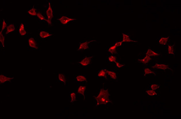 BMP8B Antibody - Staining 293 cells by IF/ICC. The samples were fixed with PFA and permeabilized in 0.1% Triton X-100, then blocked in 10% serum for 45 min at 25°C. The primary antibody was diluted at 1:200 and incubated with the sample for 1 hour at 37°C. An Alexa Fluor 594 conjugated goat anti-rabbit IgG (H+L) Ab, diluted at 1/600, was used as the secondary antibody.