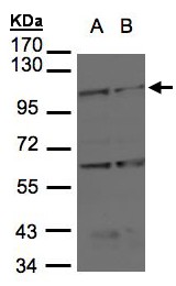 BMPR2 Antibody - Sample (30 ug of whole cell lysate). A: H1299, B: Raji . 7.5% SDS PAGE. BMPR-II / BMPR2 antibody diluted at 1:1000